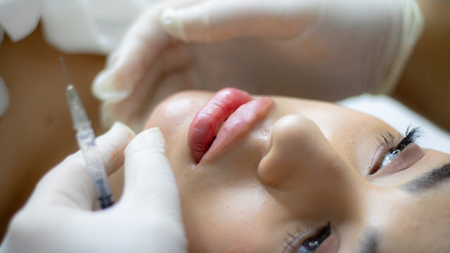 buy dermal fillers online
